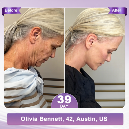 2 FDA Official: 𝐇𝐈𝐒𝐊𝐈𝐍® 𝐏𝐃𝐑𝐍 𝐌𝐮𝐥𝐭𝐢-𝐏𝐞𝐩𝐭𝐢𝐝𝐞 𝐌𝐚𝐬𝐬𝐚𝐠𝐢𝐧𝐠 𝐁𝐨𝐝𝐲 𝐑𝐨𝐥𝐥𝐞𝐫 𝐂𝐫𝐞𝐚𝐦- Anti-aging, Hydrating, Skin Firming & Lifting, Skin Repair, Even Tone, Acne and Dark Spot Treatment, Wart and Mole Removal, and Psoriasis Relief.